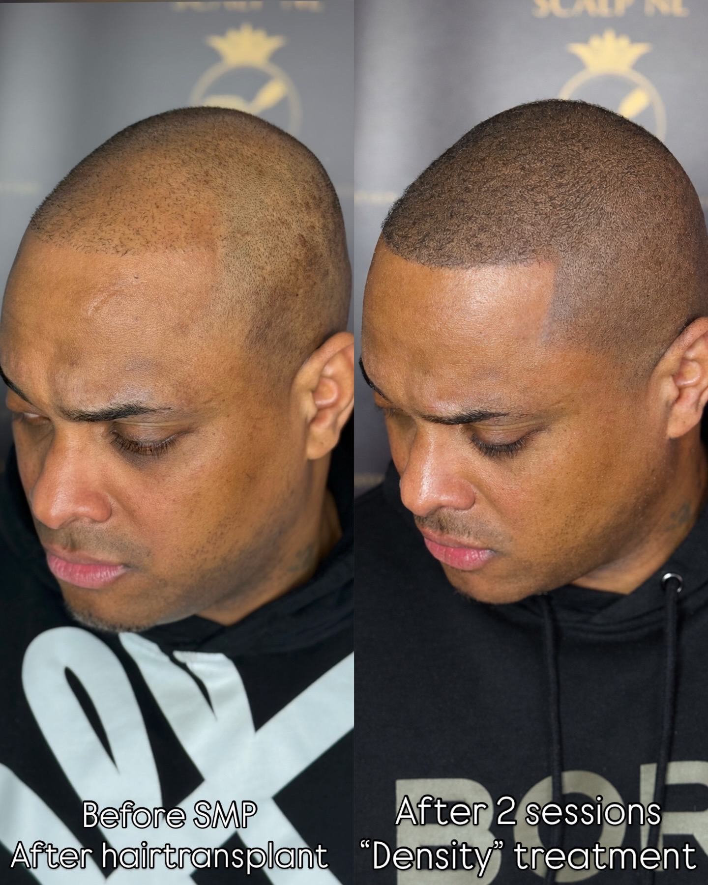 MHP resultaat Shaven Look