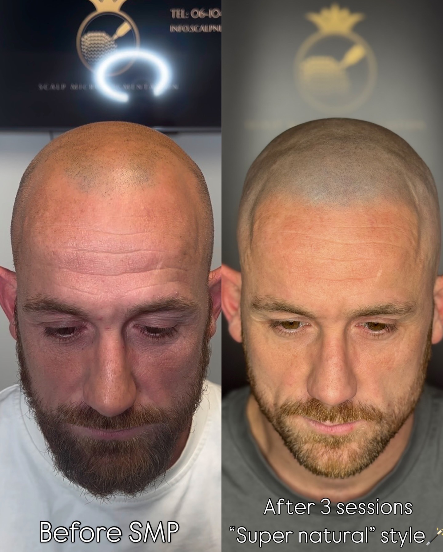 MHP resultaat Shaven Look