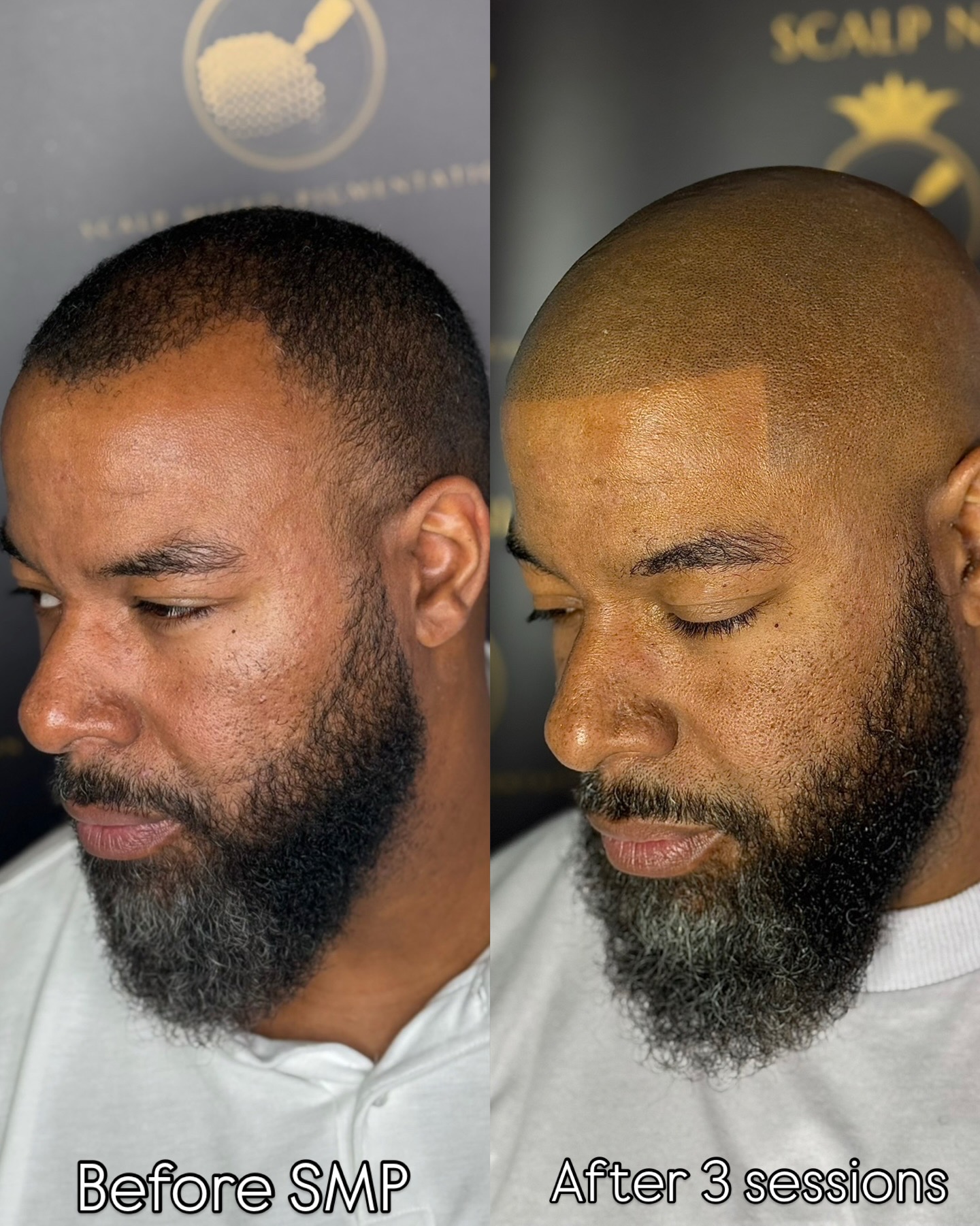 MHP resultaat Shaven Look