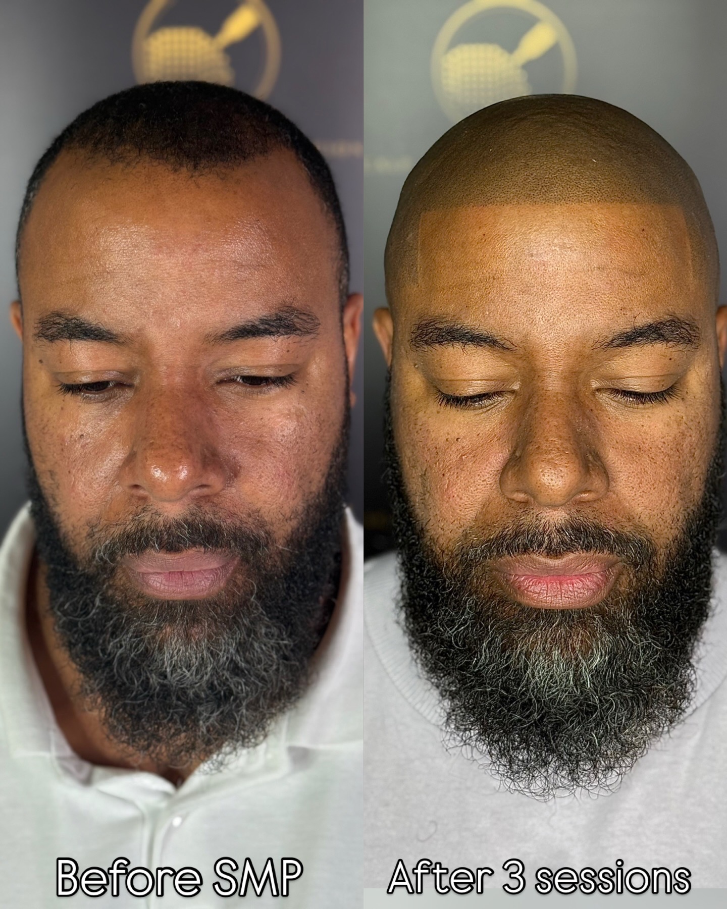 MHP resultaat Shaven Look