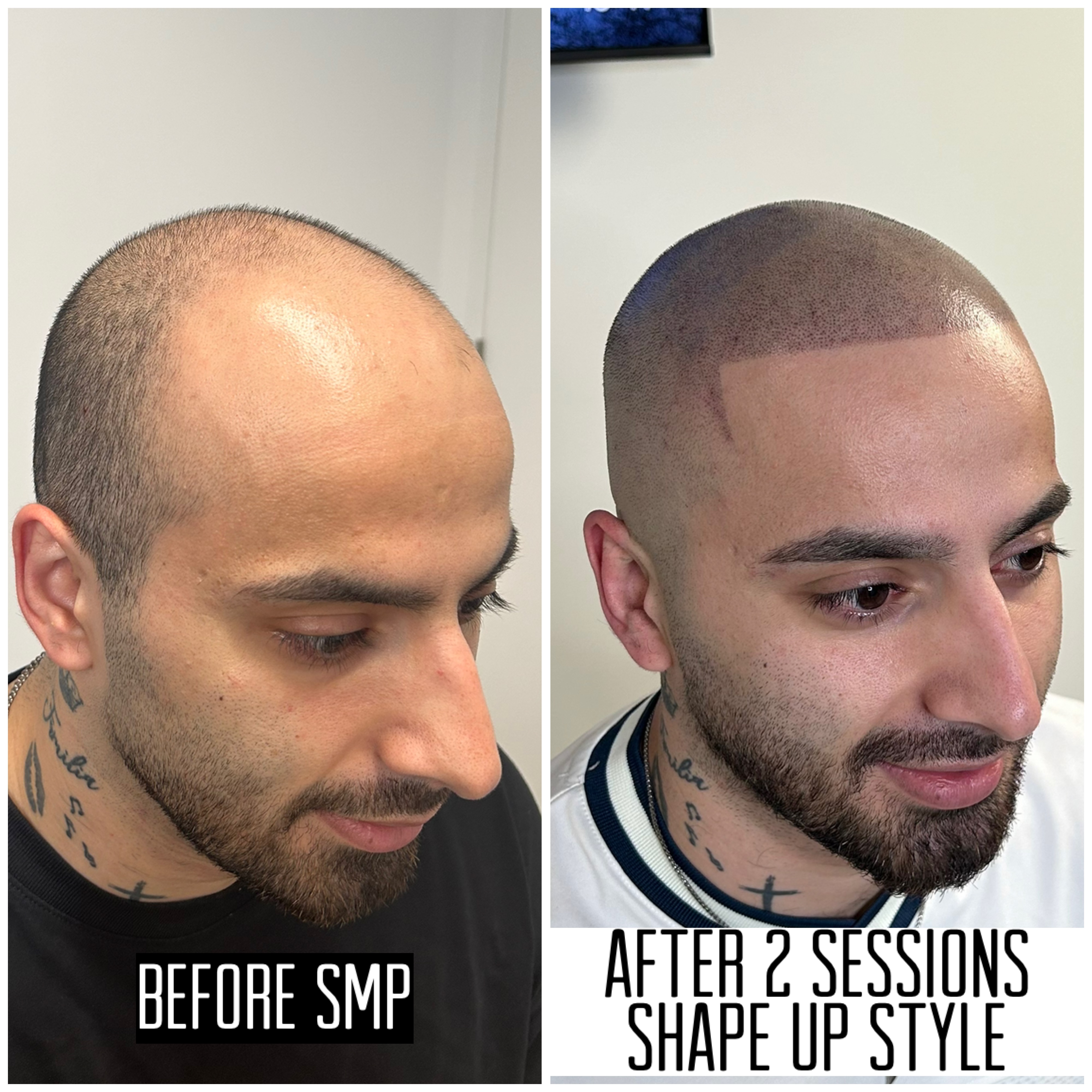 MHP resultaat Shaven Look